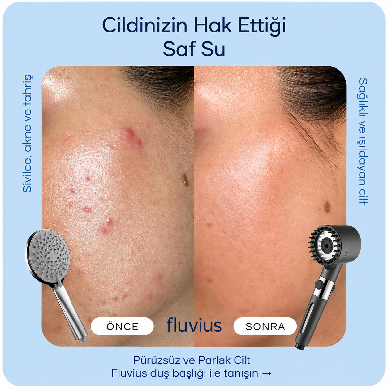 Fluvius™ Filtreli Duş Başlığı