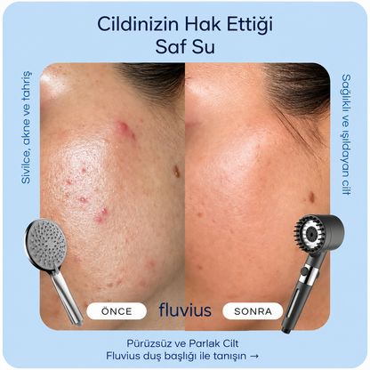 Fluvius™ Filtreli Duş Başlığı